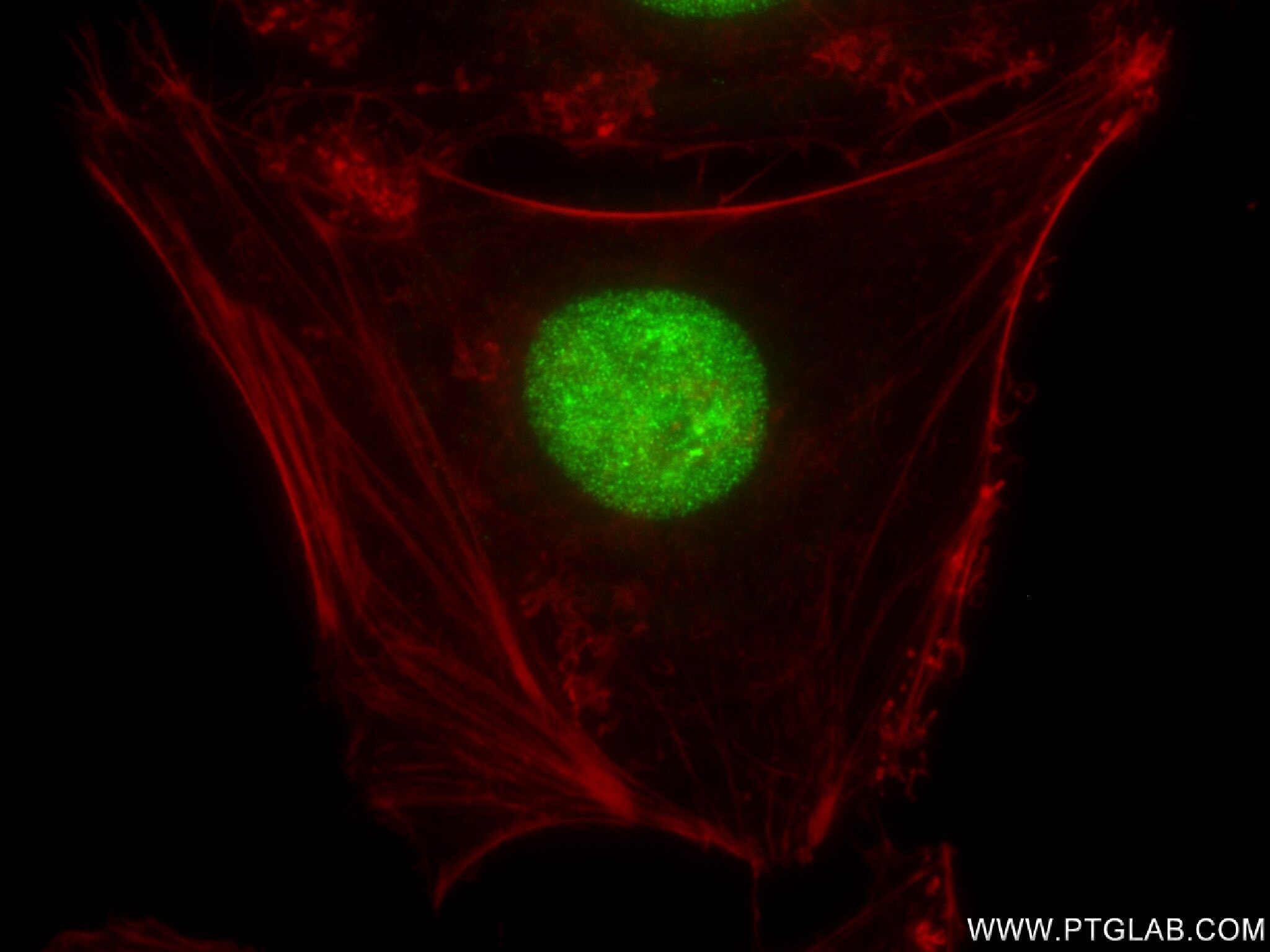 Immunofluorescence (IF) / fluorescent staining of HeLa cells using CBX1 Recombinant antibody (83248-3-RR)