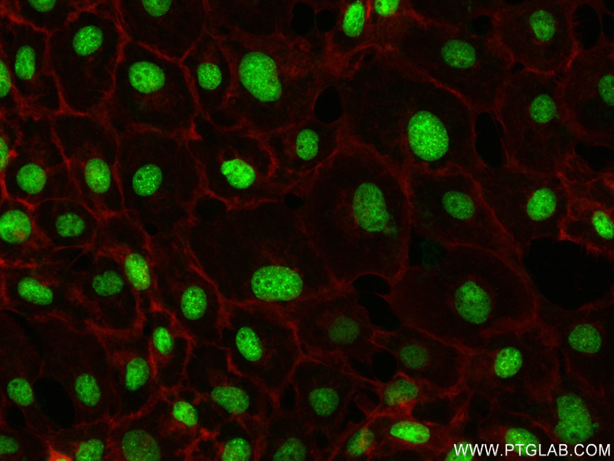 Immunofluorescence (IF) / fluorescent staining of A431 cells using CBX1 Recombinant antibody (83248-3-RR)