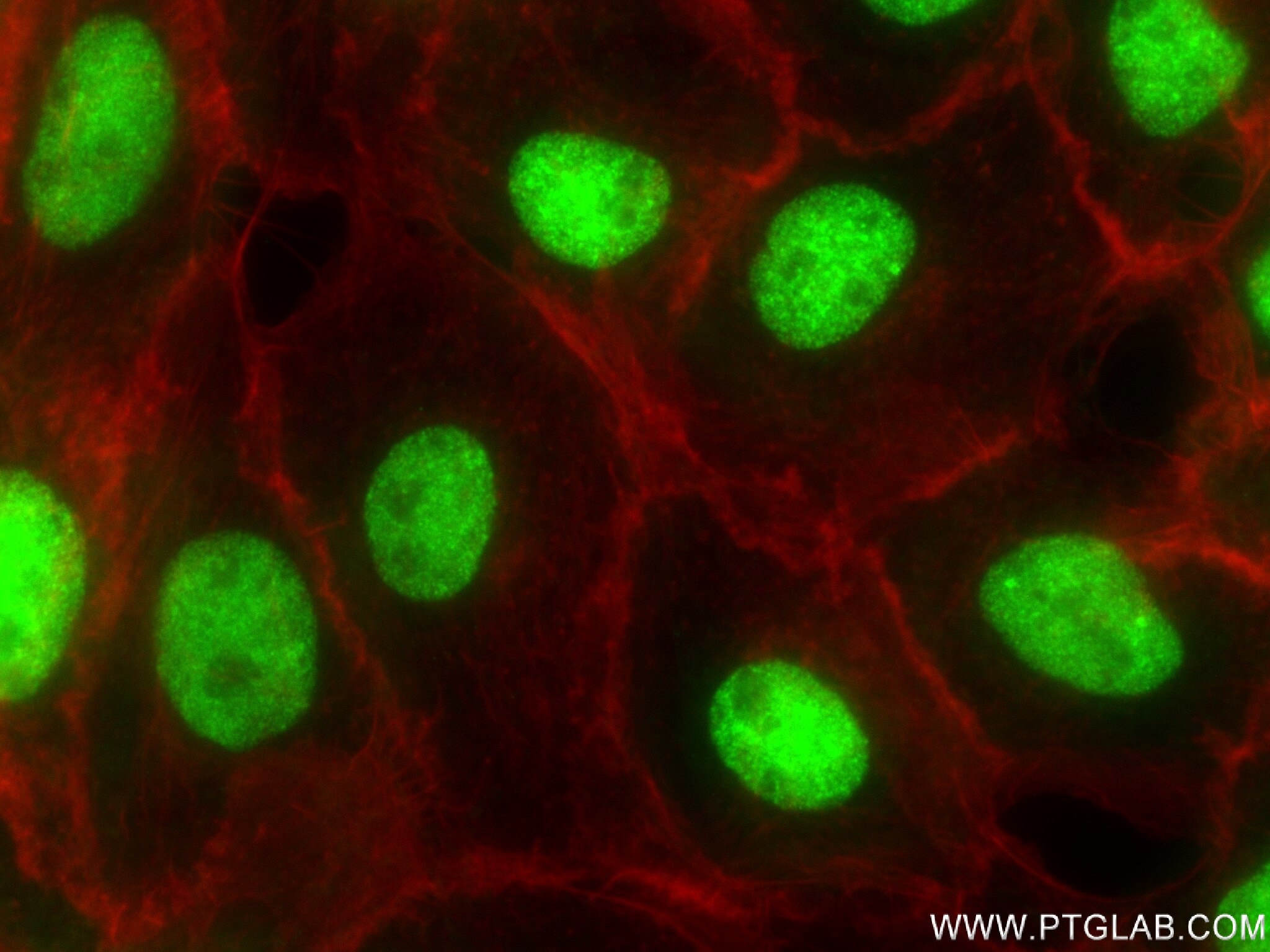 Immunofluorescence (IF) / fluorescent staining of A431 cells using CBX1 Recombinant antibody (83248-3-RR)