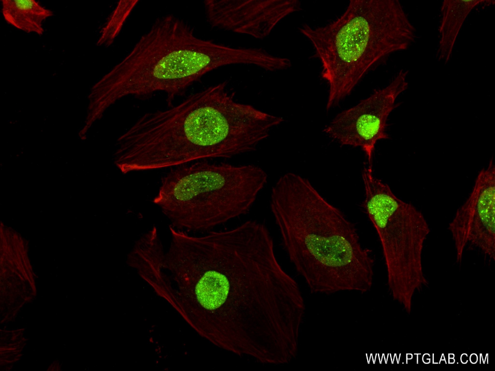 Immunofluorescence (IF) / fluorescent staining of HeLa cells using CBX1 Recombinant antibody (83248-4-RR)