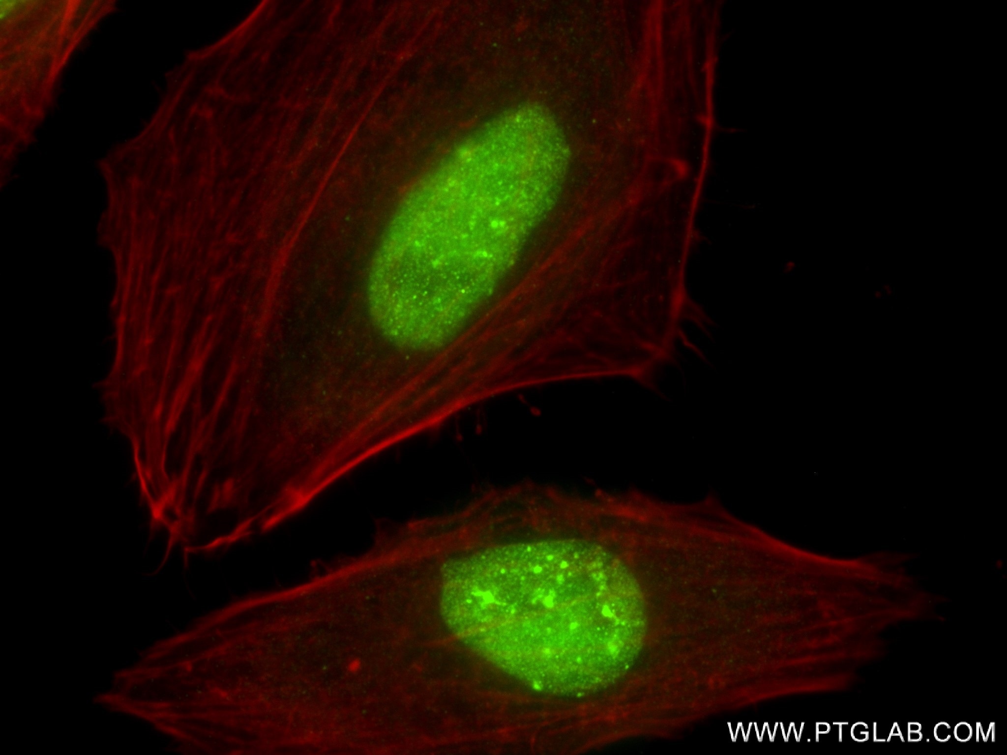 Immunofluorescence (IF) / fluorescent staining of HeLa cells using CBX1 Recombinant antibody (83248-4-RR)