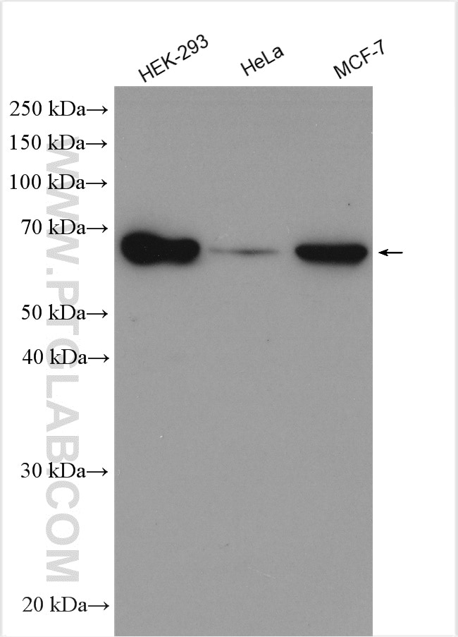 Western Blot (WB) analysis of various lysates using CBX2 Polyclonal antibody (15579-1-AP)