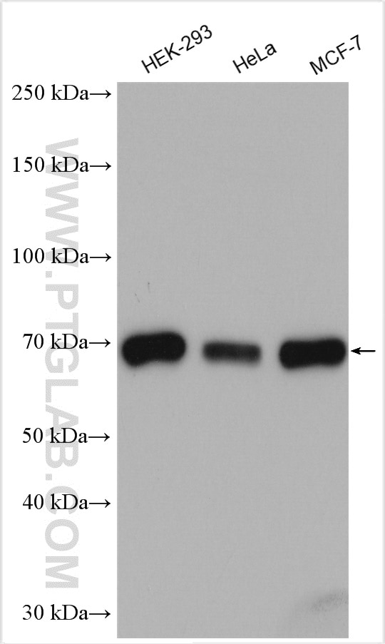 Western Blot (WB) analysis of various lysates using CBX2 Polyclonal antibody (15579-1-AP)