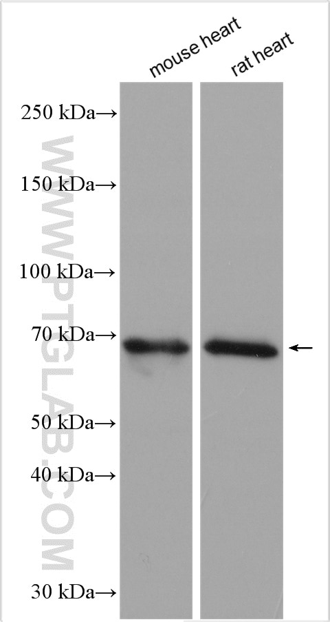 Western Blot (WB) analysis of various lysates using CBX2 Polyclonal antibody (15579-1-AP)