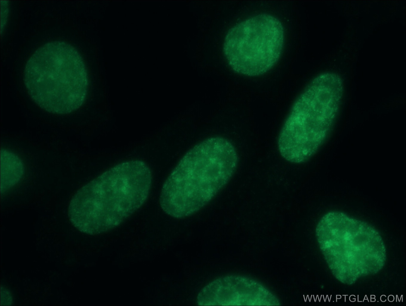 Immunofluorescence (IF) / fluorescent staining of HepG2 cells using CBX3 Polyclonal antibody (11650-2-AP)