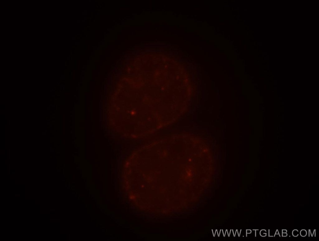 Immunofluorescence (IF) / fluorescent staining of HepG2 cells using CBX3 Polyclonal antibody (11650-2-AP)