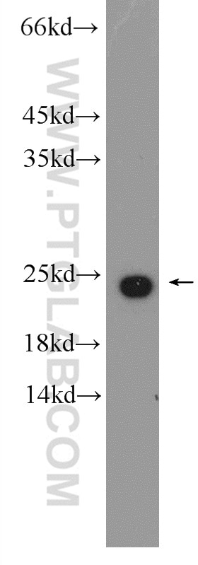 Western Blot (WB) analysis of mouse spleen tissue using CBX3 Polyclonal antibody (11650-2-AP)
