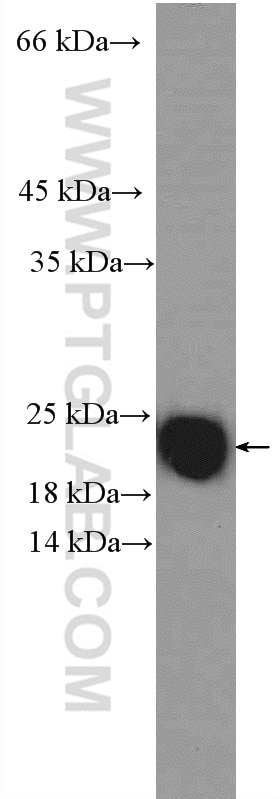 Western Blot (WB) analysis of mouse spleen tissue using CBX3 Polyclonal antibody (11650-2-AP)