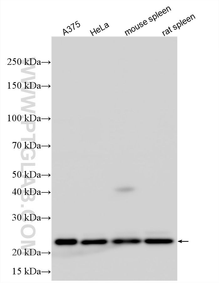 Western Blot (WB) analysis of various lysates using CBX3 Polyclonal antibody (11650-2-AP)