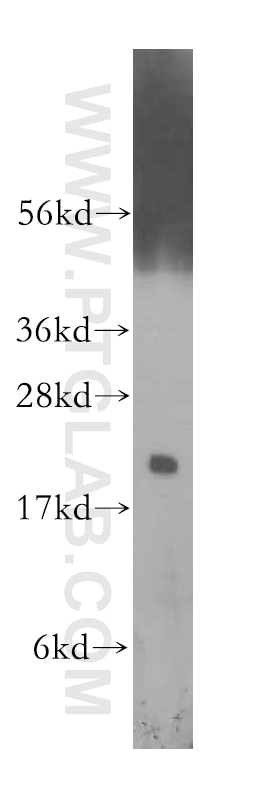 Western Blot (WB) analysis of A375 cells using CBX3 Polyclonal antibody (11650-2-AP)