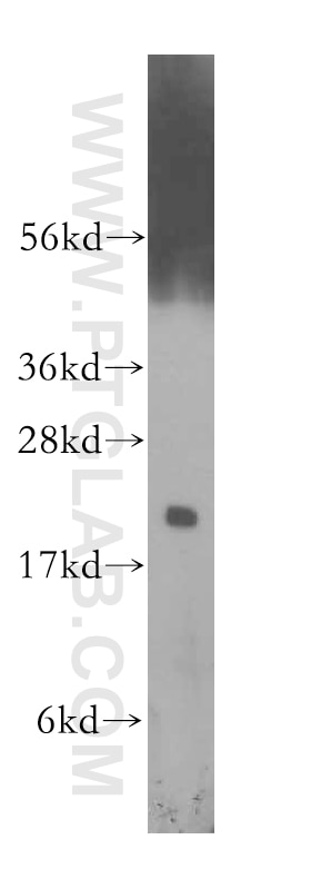 WB analysis of A375 using 11650-2-AP