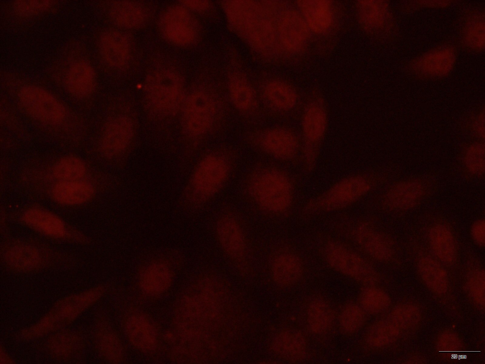 IF Staining of HepG2 using 66446-1-Ig
