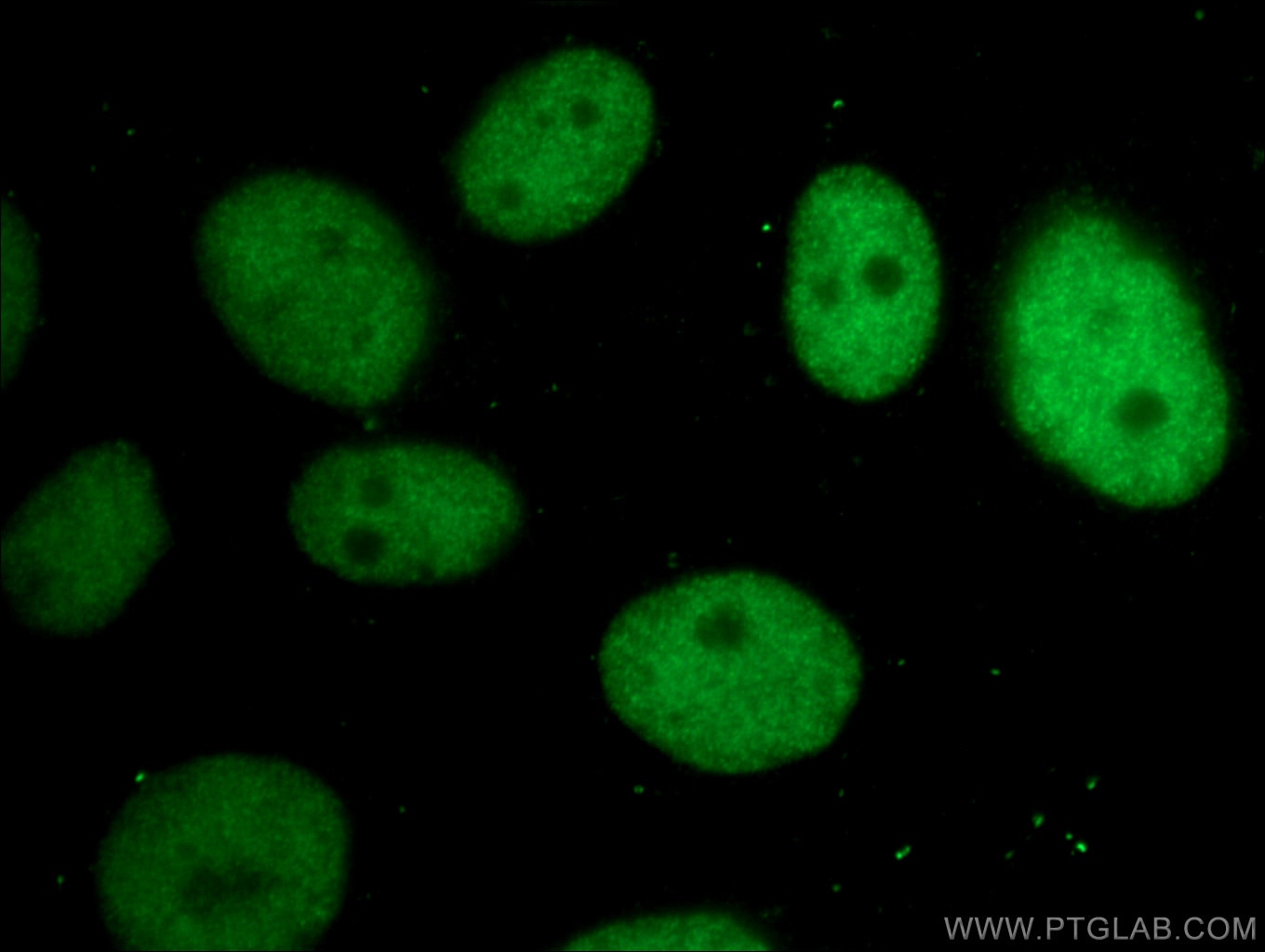 Immunofluorescence (IF) / fluorescent staining of HepG2 cells using CBX3 Monoclonal antibody (66446-1-Ig)