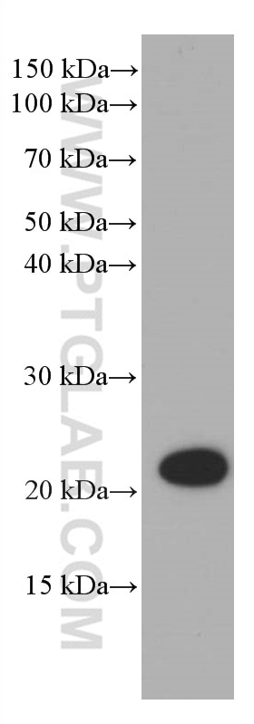 Western Blot (WB) analysis of HEK-293 cells using CBX3 Monoclonal antibody (66446-1-Ig)