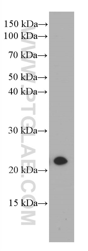 Western Blot (WB) analysis of Jurkat cells using CBX3 Monoclonal antibody (66446-1-Ig)