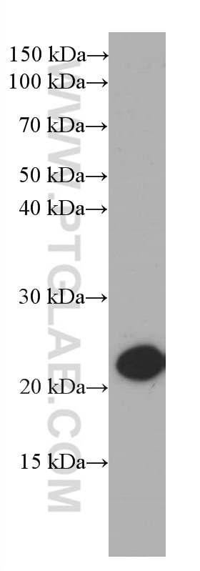 Western Blot (WB) analysis of NIH/3T3 cells using CBX3 Monoclonal antibody (66446-1-Ig)