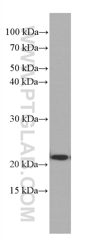 Western Blot (WB) analysis of HeLa cells using CBX3 Monoclonal antibody (66446-1-Ig)