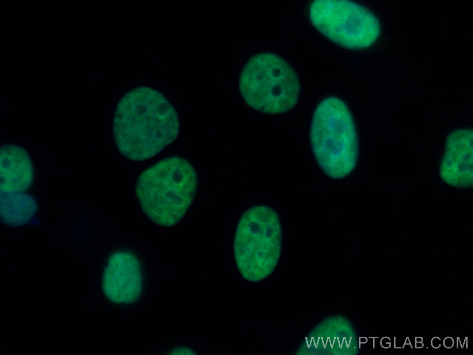 Immunofluorescence (IF) / fluorescent staining of HepG2 cells using CoraLite® Plus 488-conjugated CBX3 Monoclonal anti (CL488-66446)
