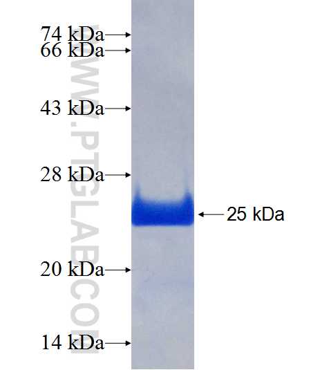 CBX3 fusion protein Ag19112 SDS-PAGE