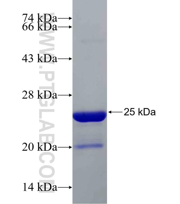 CBX3 fusion protein Ag19112 SDS-PAGE