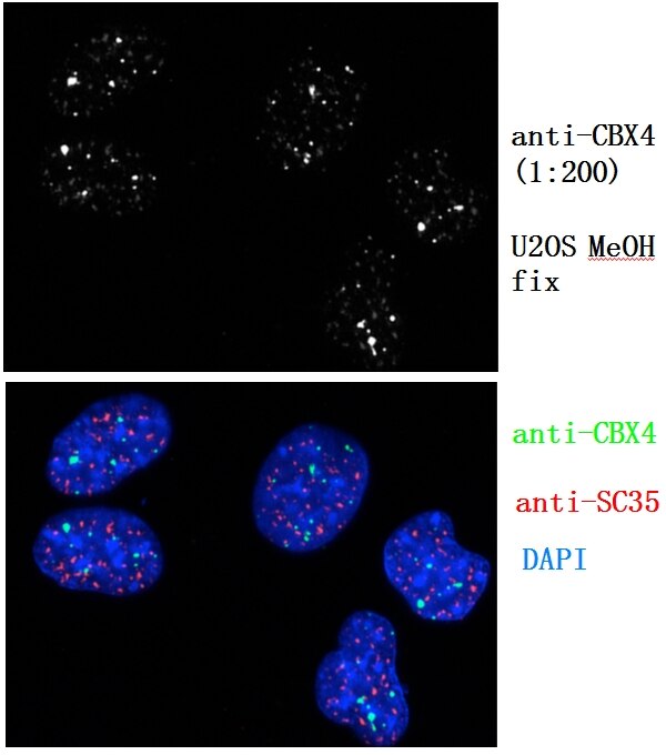 Immunofluorescence (IF) / fluorescent staining of U2OS cell using CBX4 Polyclonal antibody (18544-1-AP)