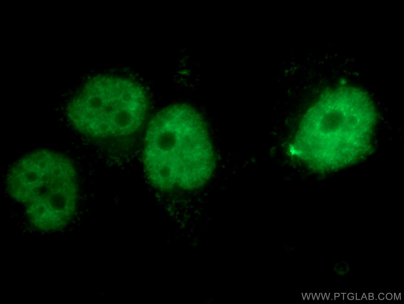 Immunofluorescence (IF) / fluorescent staining of HeLa cells using CBX4 Polyclonal antibody (18544-1-AP)