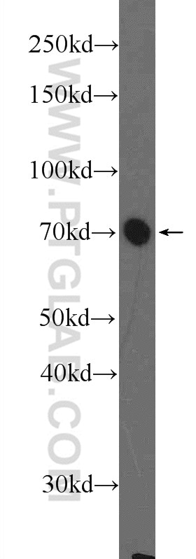 Western Blot (WB) analysis of PC-3 cells using CBX4 Polyclonal antibody (18544-1-AP)