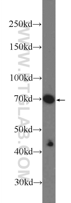Western Blot (WB) analysis of PC-3 cells using CBX4 Polyclonal antibody (18544-1-AP)