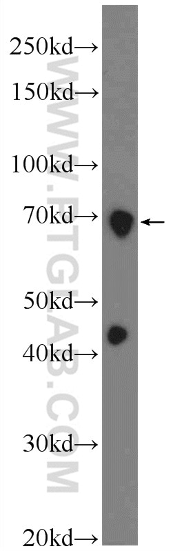 Western Blot (WB) analysis of HEK-293 cells using CBX4 Polyclonal antibody (18544-1-AP)