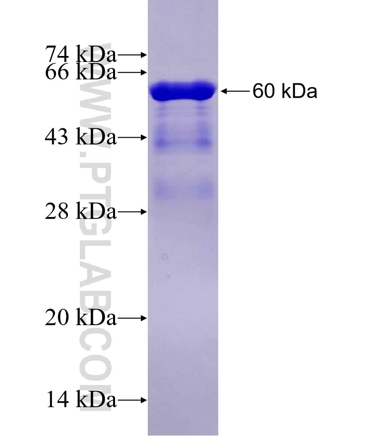 CBX4 fusion protein Ag13425 SDS-PAGE