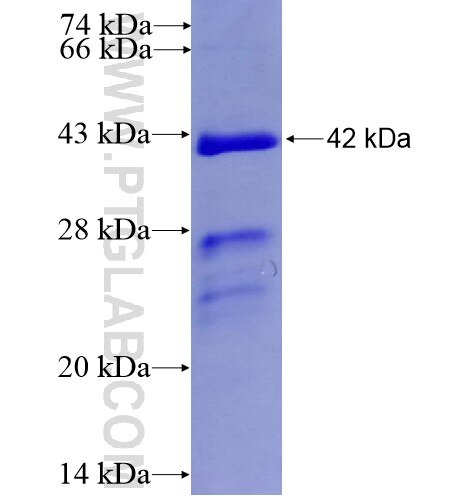 CBX4 fusion protein Ag13450 SDS-PAGE