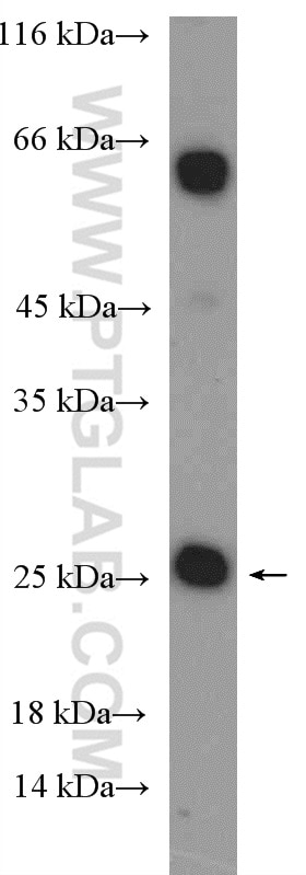 Western Blot (WB) analysis of MCF-7 cells using CBX5 Polyclonal antibody (11831-1-AP)