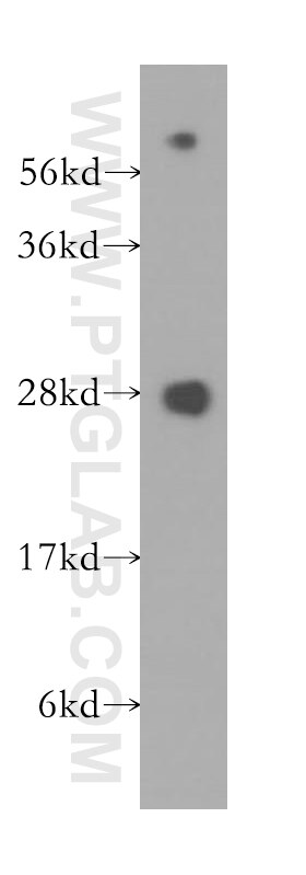 Western Blot (WB) analysis of human kidney tissue using CBX5 Polyclonal antibody (11831-1-AP)