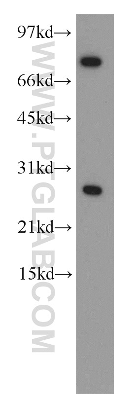 Western Blot (WB) analysis of HeLa cells using CBX5 Polyclonal antibody (11831-1-AP)