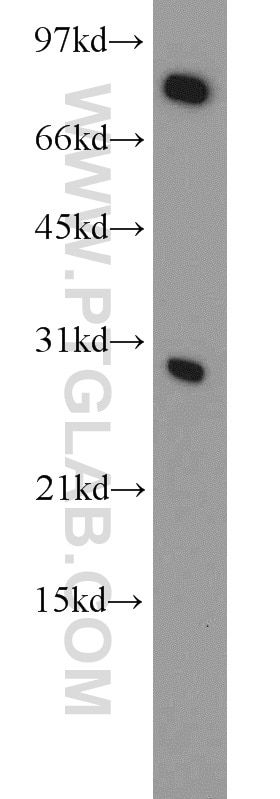 Western Blot (WB) analysis of K-562 cells using CBX5 Polyclonal antibody (11831-1-AP)