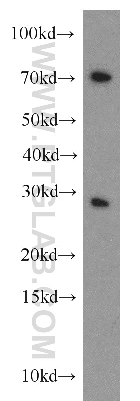 Western Blot (WB) analysis of A431 cells using CBX5 Polyclonal antibody (11831-1-AP)