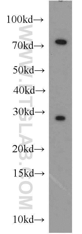 Western Blot (WB) analysis of MCF-7 cells using CBX5 Polyclonal antibody (11831-1-AP)