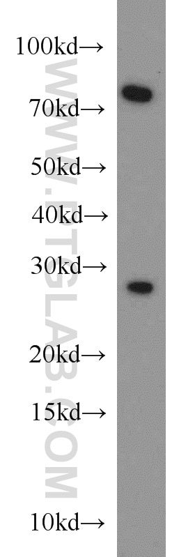 Western Blot (WB) analysis of HEK-293 cells using CBX5 Polyclonal antibody (11831-1-AP)