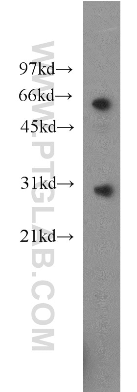 Western Blot (WB) analysis of HEK-293 cells using CBX5 Polyclonal antibody (11831-1-AP)