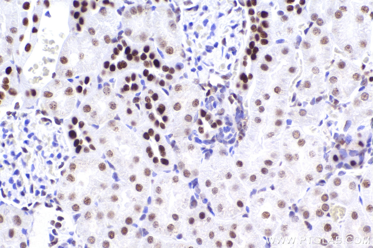 Immunohistochemistry (IHC) staining of rat kidney tissue using CBX5 Recombinant antibody (83258-5-RR)