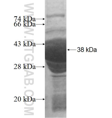 CBX5 fusion protein Ag2403 SDS-PAGE