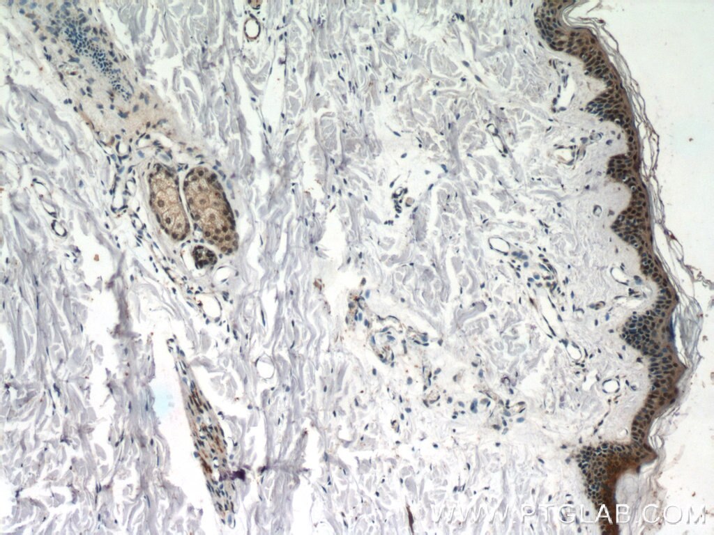 Immunohistochemistry (IHC) staining of human skin tissue using CBX6 Polyclonal antibody (23426-1-AP)