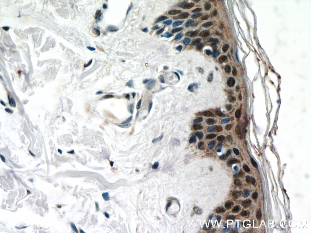 Immunohistochemistry (IHC) staining of human skin tissue using CBX6 Polyclonal antibody (23426-1-AP)