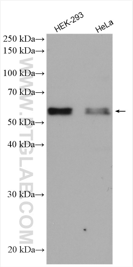 Western Blot (WB) analysis of various lysates using CBX6 Polyclonal antibody (23426-1-AP)