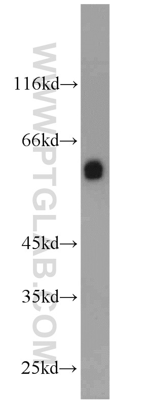 Western Blot (WB) analysis of HepG2 cells using CBX6 Polyclonal antibody (23426-1-AP)