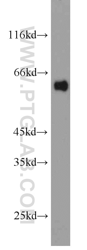 Western Blot (WB) analysis of HepG2 cells using CBX6 Polyclonal antibody (23426-1-AP)