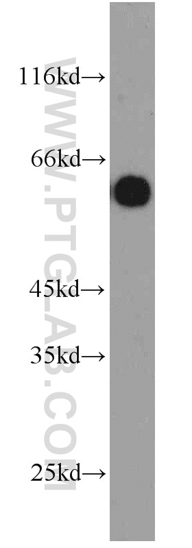 Western Blot (WB) analysis of HepG2 cells using CBX6 Polyclonal antibody (23426-1-AP)