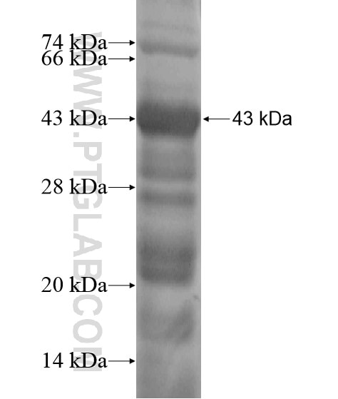 CBX6 fusion protein Ag20014 SDS-PAGE