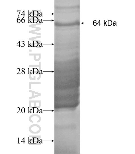 CBX6 fusion protein Ag20053 SDS-PAGE