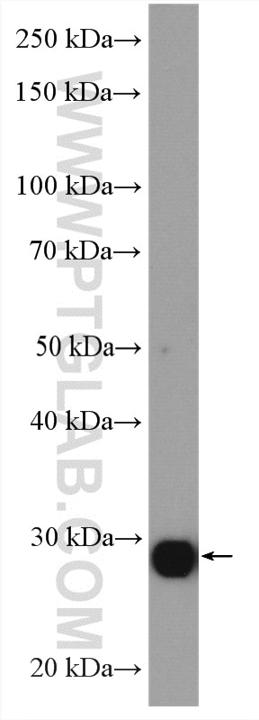 Western Blot (WB) analysis of mouse liver tissue using CBX7 Polyclonal antibody (26278-1-AP)